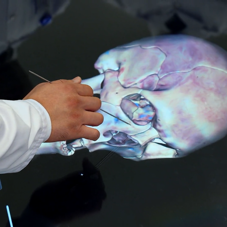 Kelle&ccedil;anagyň &yacute;&uuml;z b&ouml;leginiň s&uuml;ňkleri. s&uuml;ňkleri gurluşy we topografi&yacute;asy. Anatomage 3D enjamynda amaly sapak.